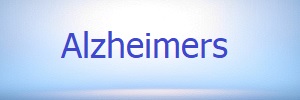 Alzheimers Final