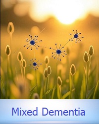 mixed dementia signs facts