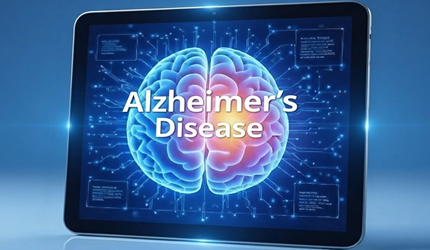Azheimers disease explained details mobile